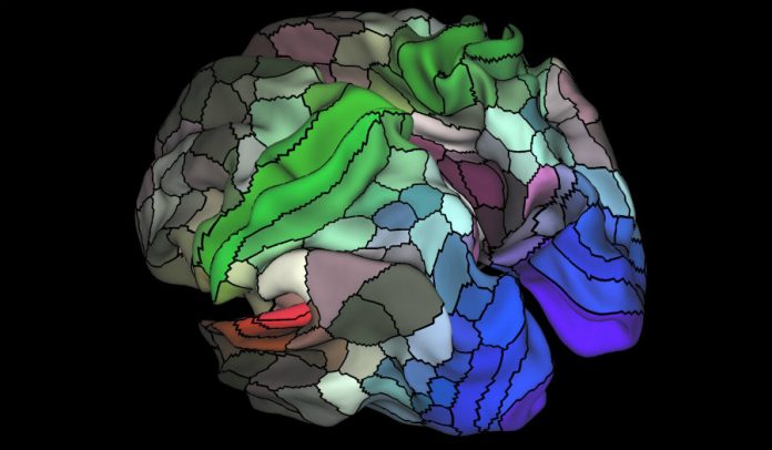 Brain scan of damaged parts in the brain