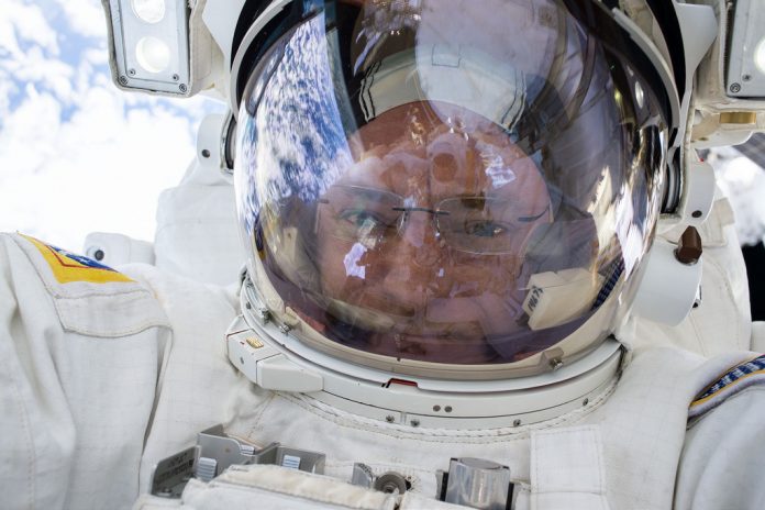 Spaceflight brain