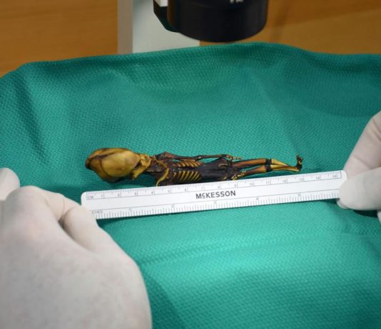 Atacama alien mummy mystery solved: human fetus with severe mutations