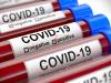 Jean Danhong Chen on Easing the Fear for Immigrants to get COVID-19 Testing