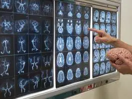 One Person Infected With Rare Brain-Eating Amoeba in Florida; Authorities Issue Warnings