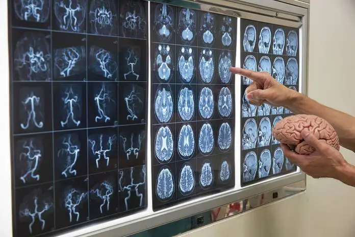 One Person Infected With Rare Brain-Eating Amoeba in Florida; Authorities Issue Warnings One Person Infected With Rare Brain-Eating Amoeba in Florida; Authorities Issue Warnings