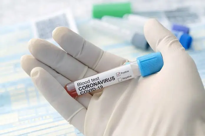 147 COVID-19 Infections, 3 Deaths, and Jail Outbreak Linked to Wedding Reception 147 COVID-19 Infections, 3 Deaths, and Jail Outbreak Linked to Wedding Reception