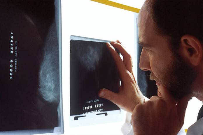 Innovative Cancer Treatment with HIPEC Innovative Cancer Treatment with HIPEC