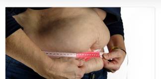 Bariatric Surgery Recommended For Obese Patients with Fatty Liver Problems