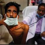 WHO Says 10.6 Million People Infected With Tuberculosis in 2021 WHO Says 10.6 Million People Infected With Tuberculosis in 2021