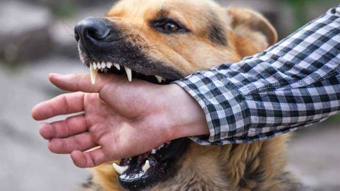 Dogs Maul Man to Death, Injures Woman and Firefighter; Charges May Be Filed Dogs Maul Man to Death, Injures Woman and Firefighter; Charges May Be Filed